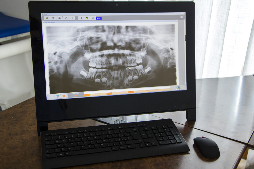 Radiologia Digitale Odontoiatrica